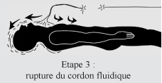  La rupture du cordon fluidique